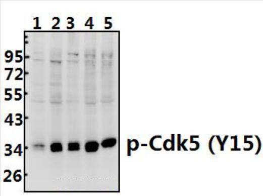 Cdk5 (phospho~Y15)