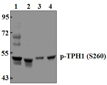 TPH1 (phospho~S260)