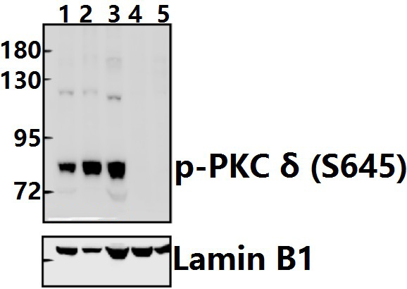 PKC δ (phospho~S645)