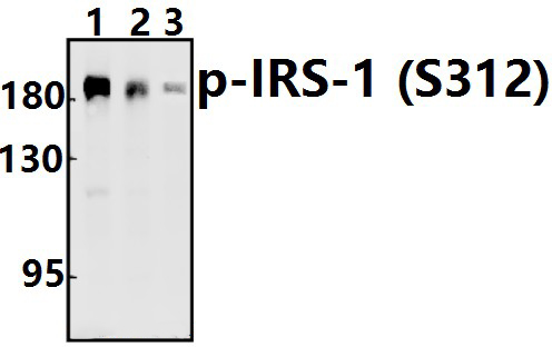 IRS~1 (phospho~S312)