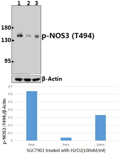 NOS3 (phospho~T494)