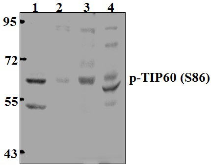 TIP60 (phospho~S86)