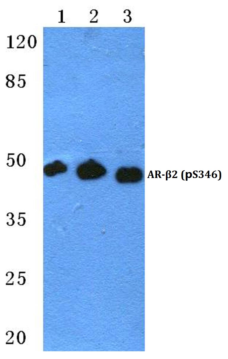 AR~β2 (phospho~S346)