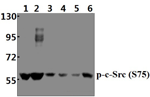 c~Src (phospho~S75)