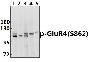GluR4 (phospho~S862)
