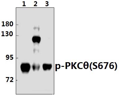 PKC θ (phospho~S676)