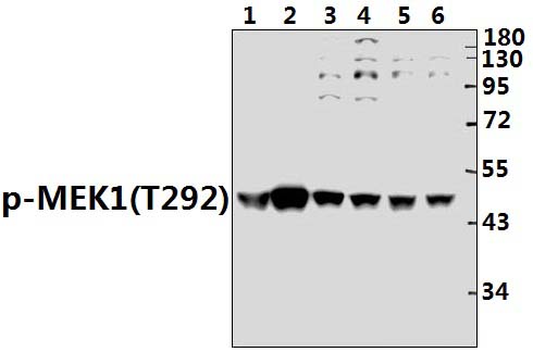 MEK1 (phospho~T292)