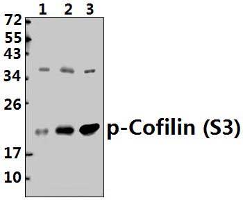 Cofilin (phospho~S3)