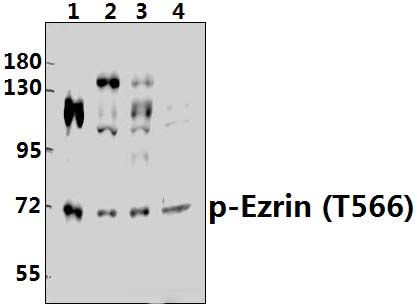 Ezrin (phospho~T567)/Radixin (phospho~T564)/Moesin (phospho~T558)