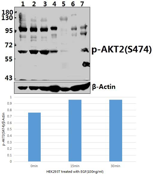 AKT2 (phospho~S474)