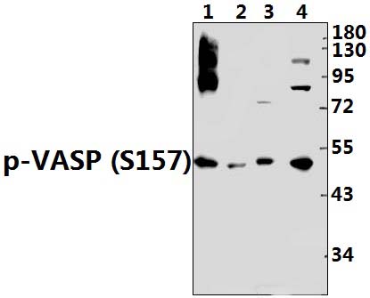 VASP (phospho~S157)