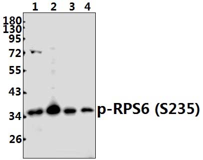 RPS6 (phospho~S235)