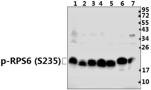 4E~BP1 (phospho~T46)