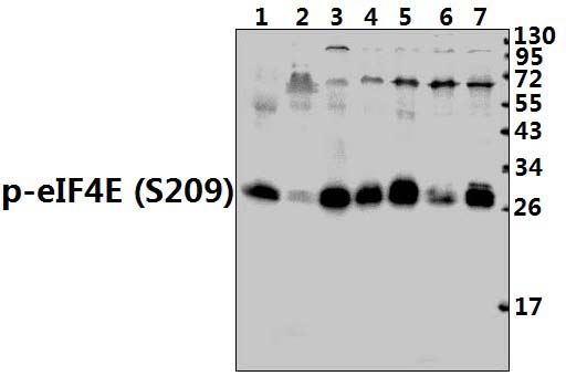 eIF4E (phospho~S209)