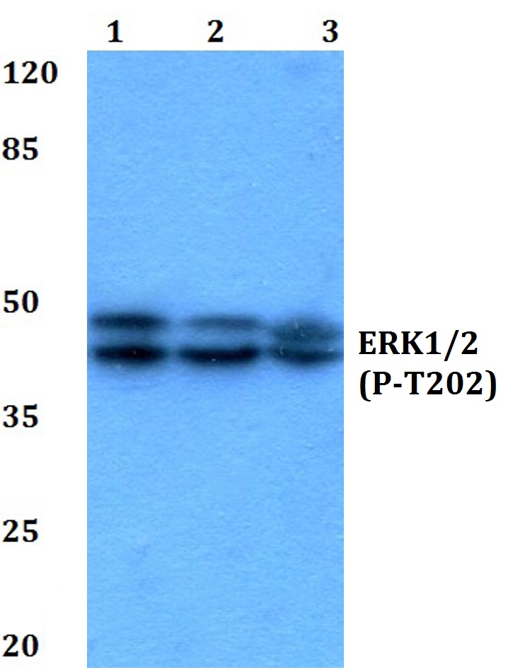 ERK 1/2 (phospho~T202)