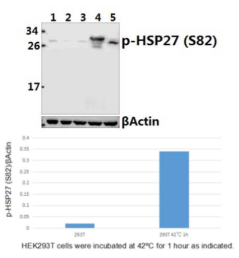 HSP27 (phospho~S82)