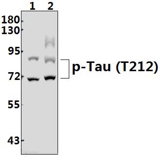 Tau (phospho~T212)