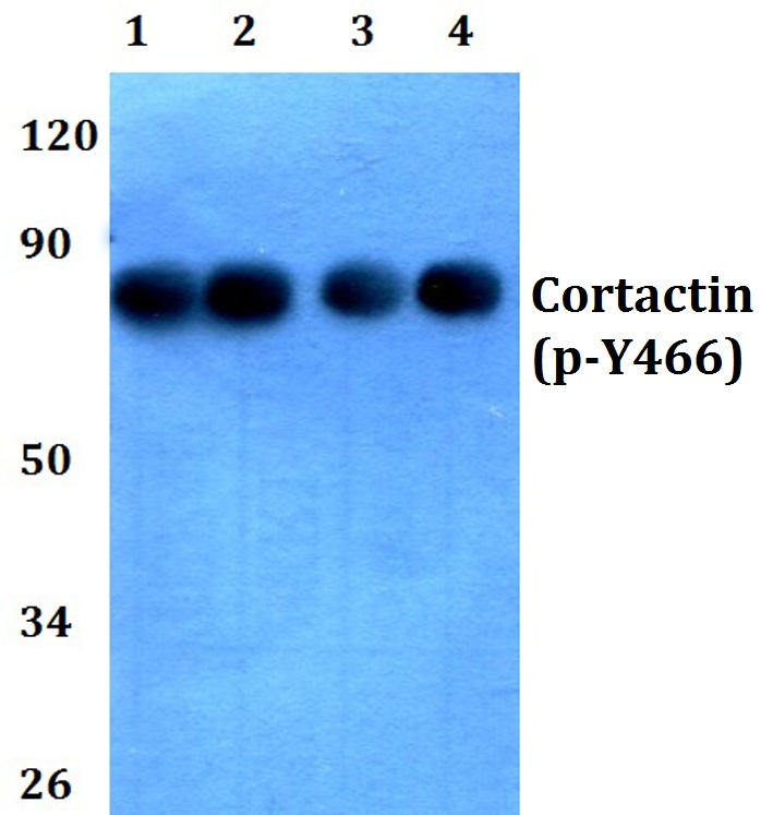 Cortactin (phospho~Y466)