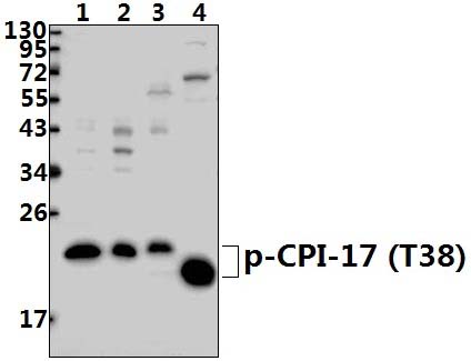 CPI~17 (phospho~T38)