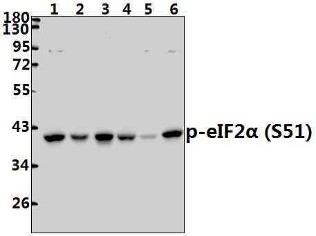 eIF2α (phospho~S51)