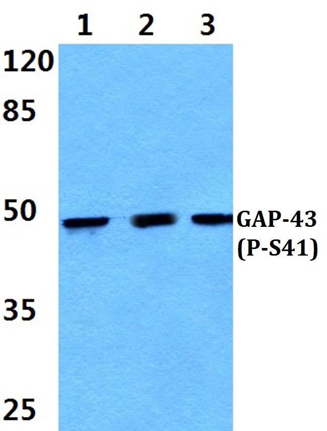 GAP43 (phospho~S41)