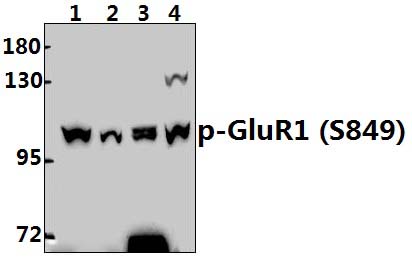 GluR1 (phospho~S849)