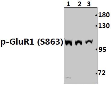 GluR1 (phospho~S863)