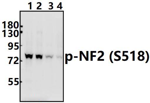 NF2/Merlin (phospho~S518)