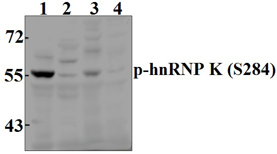 hnRNP K (phospho~S284)
