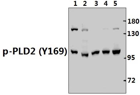 PLD2 (phospho~Y169)