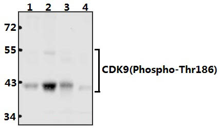 Cdk9 (phospho~T186) polyclonal antibody