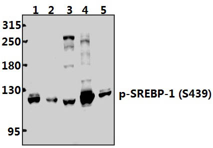 SREBP~1 (phospho~S439) polyclonal antibody