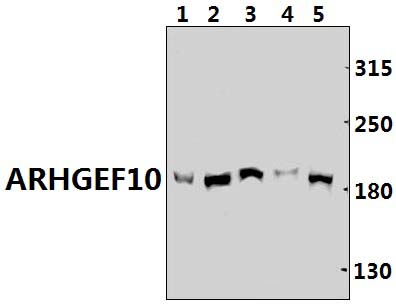 ARHGEF10