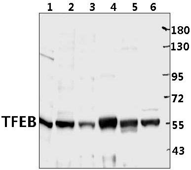 TFEB
