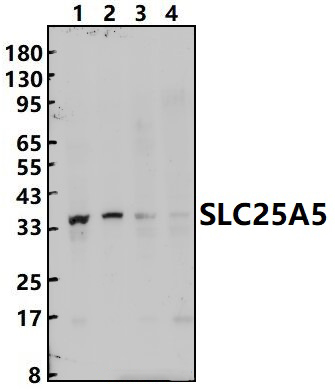 SLC25A5