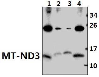 MT~ND3