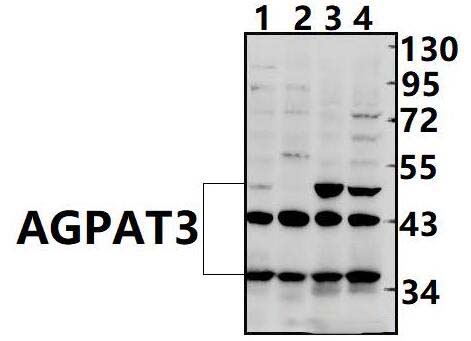 AGPAT3