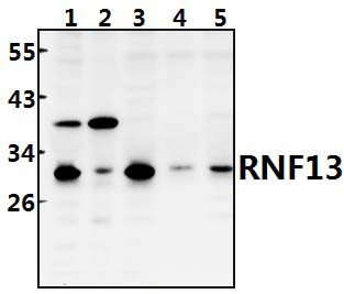 RNF138