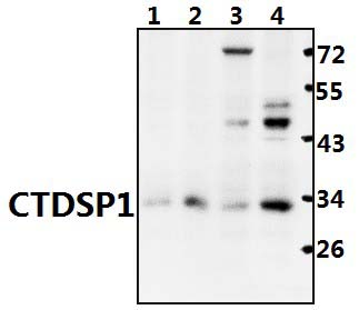 CTDSP1