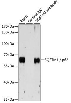 Rabbit polyclonal antibody to SQSTM1 / p62