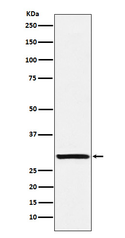Intra Acrosomal Protein