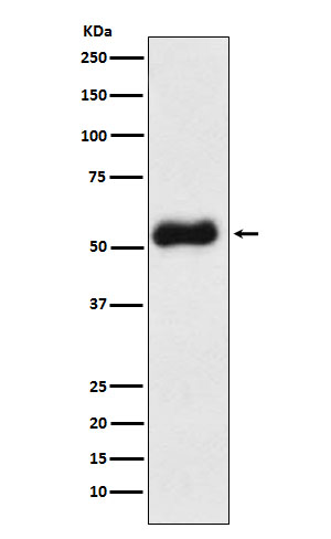 Thromboxane synthase