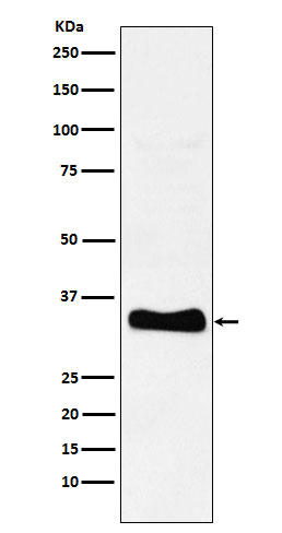 Monoacylglycerol Lipase