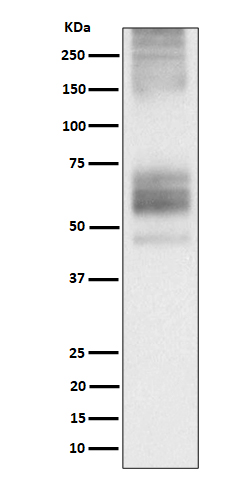 Somatostatin Receptor 1