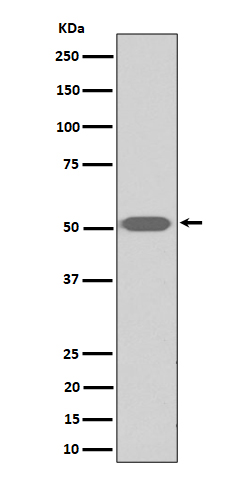 Thromboxane A2 receptor