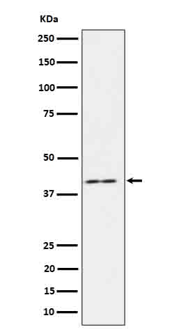 IL18 binding protein