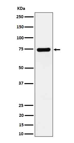 Dopamine beta Hydroxylase