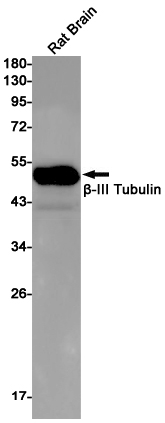 beta III Tubulin