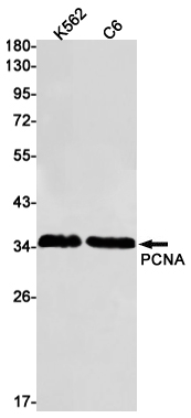 PCNA