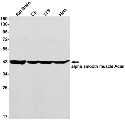 alpha smooth muscle Actin